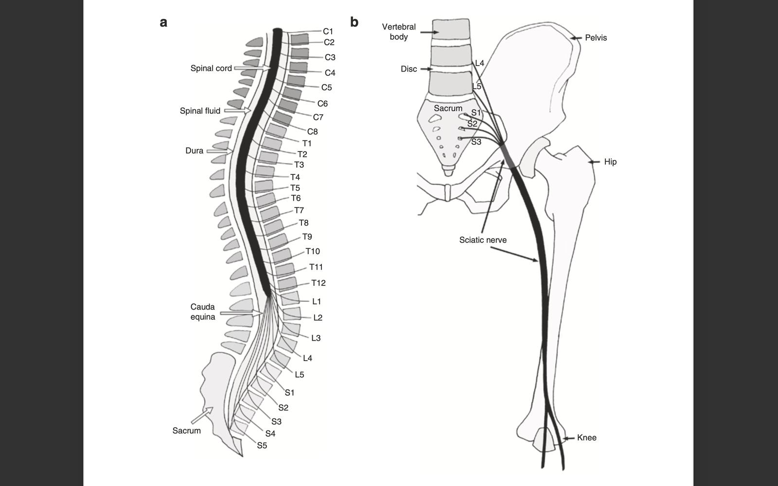 Sciatic symptoms